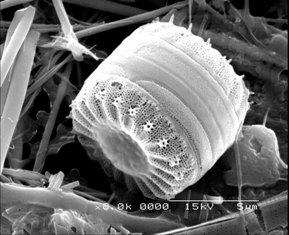 Diatomea al microscopio Diatomea al microscopio