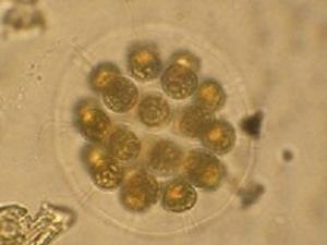 Fitoplancton al microscopio Fitoplancton al microscopio